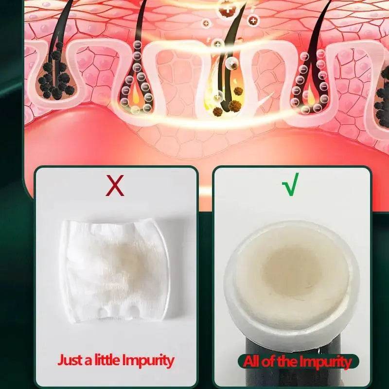 4+3 Kit Ultrasonic Skin Scrubber - Afrotix