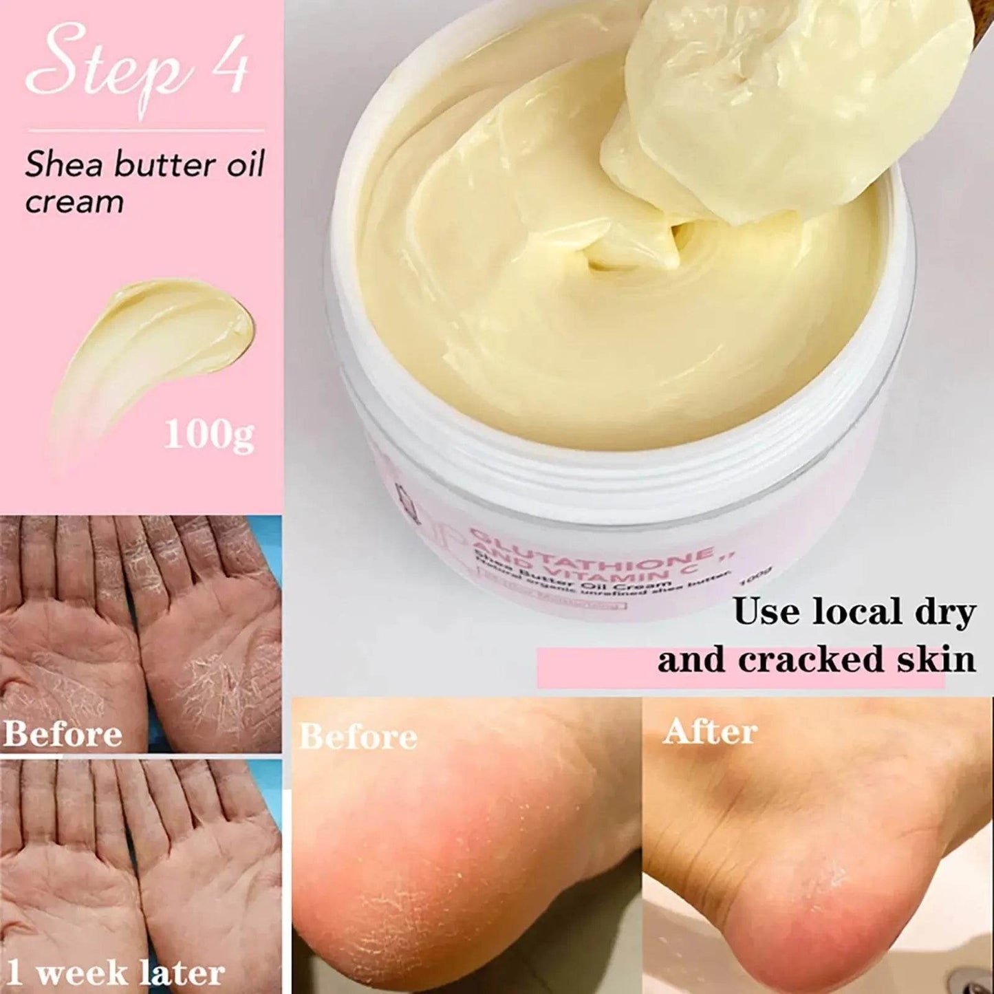 AILKE Whitening Remove Black Spots Facial Skin Care Lotion - Afrotix