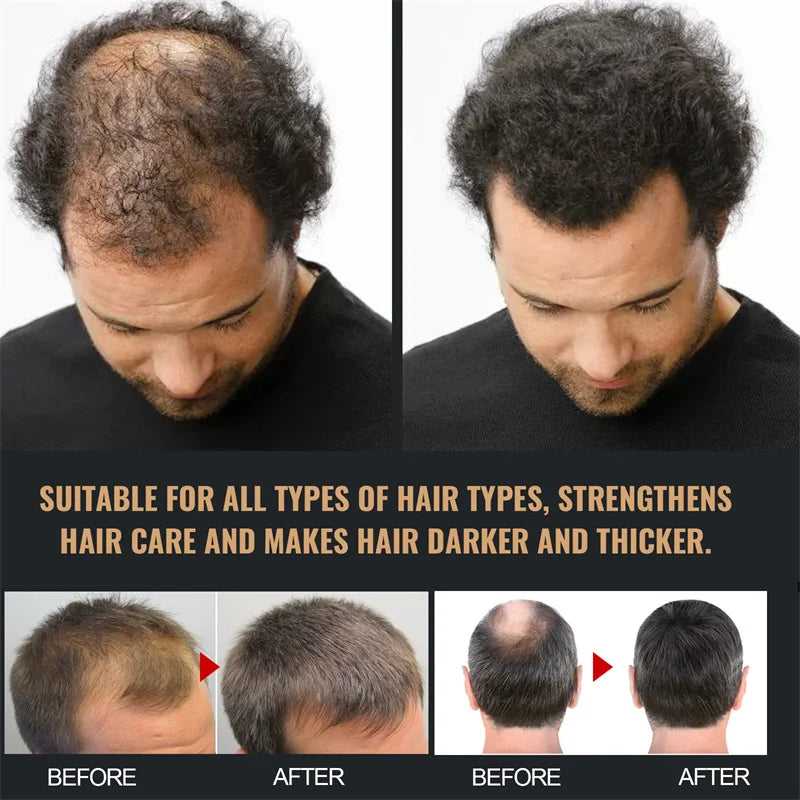 Hair Growth Shampoo - Afrotix