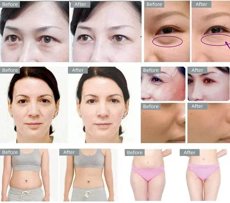 Body Slimming 40K Cavitation Ultrasonic Beauty Machine - Afrotix