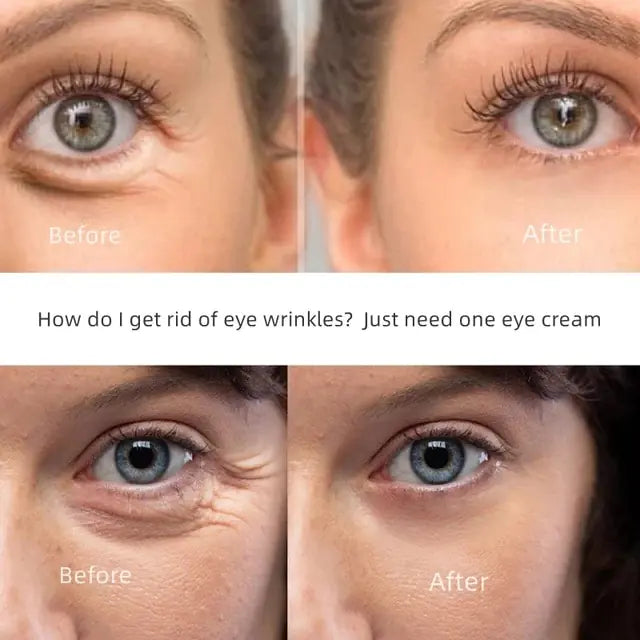 New Anti-Wrinkle Eye Cream - Afrotix