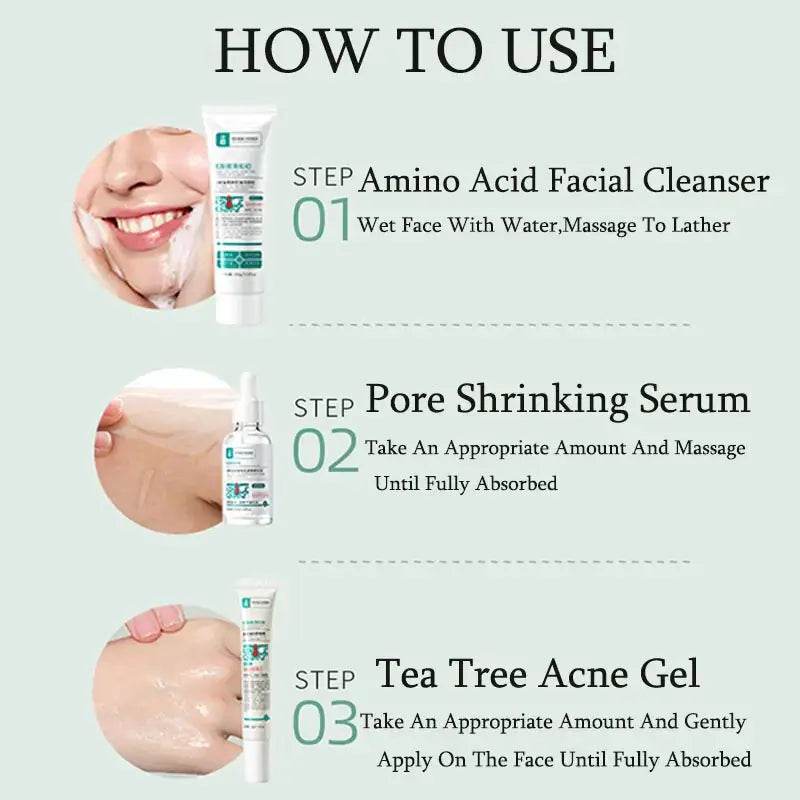 Herbal Acne Removal Face Cream - Afrotix