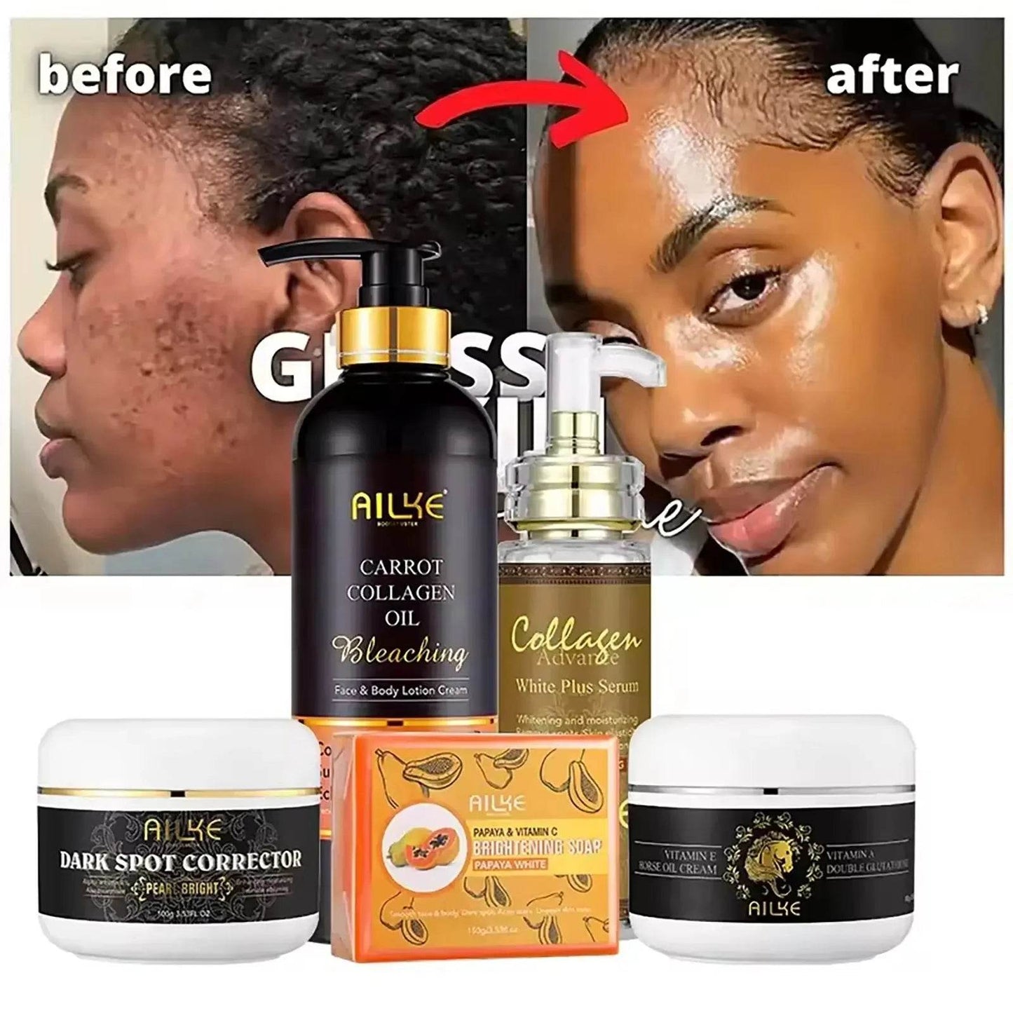 Kit de soins de la peau 5 en 1 au collagène AILKE, - Afrotix