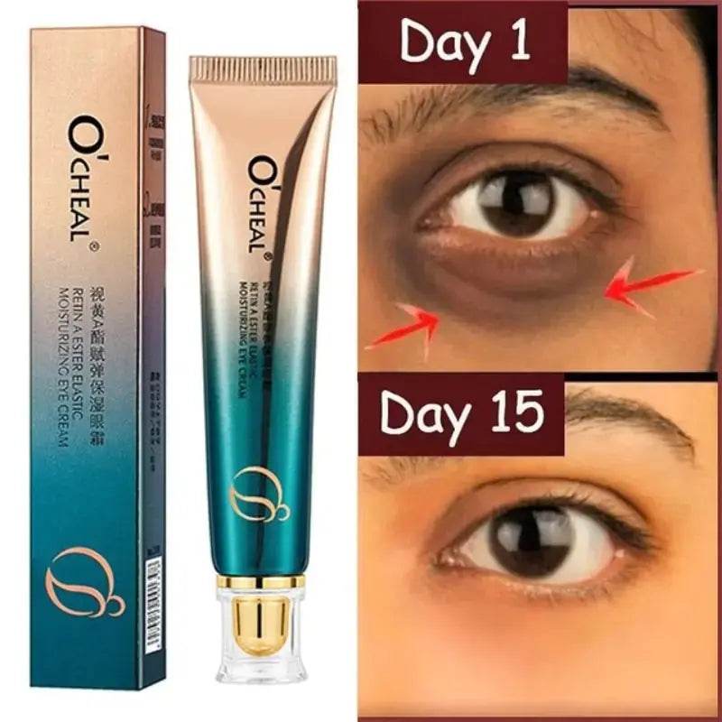 New Anti-Wrinkle Eye Cream - Afrotix