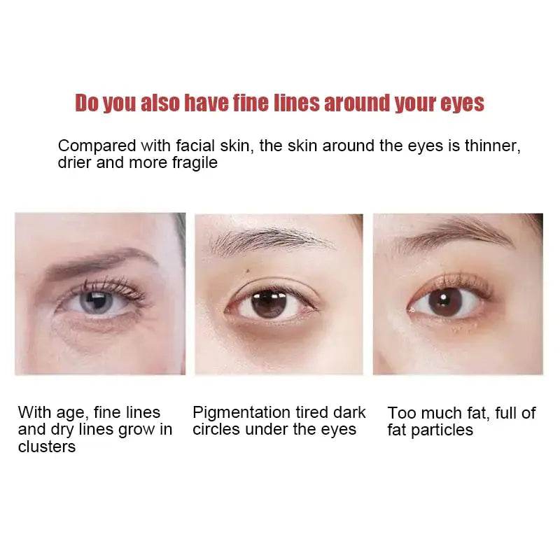 New Anti-Wrinkle Eye Cream - Afrotix