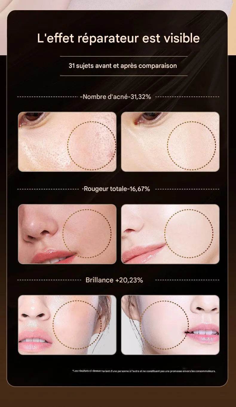 New Masque Lumière Rouge Photon Rajeunissement .. - Afrotix
