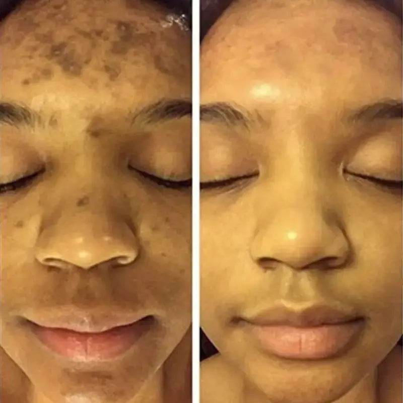 Turmeric Face Whitening Serum - Afrotix