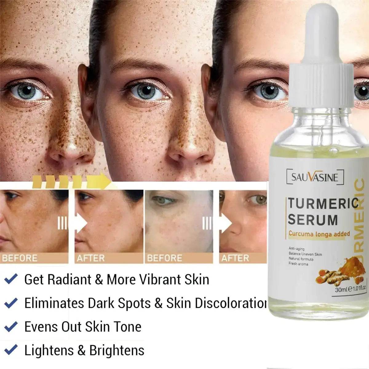 Turmeric Face Whitening Serum - Afrotix