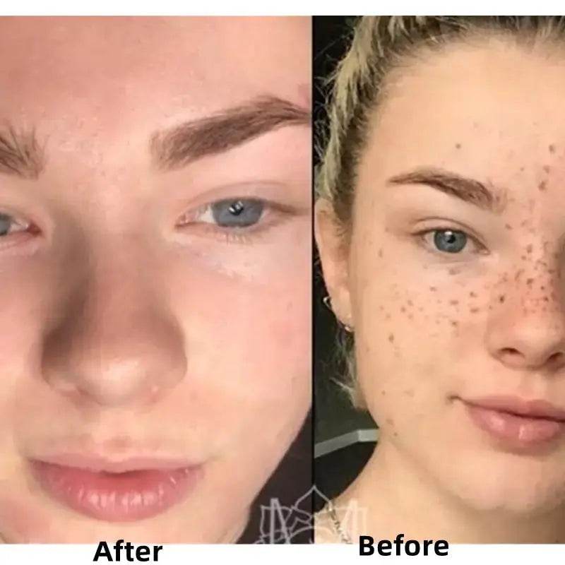 Turmeric Face Whitening Serum - Afrotix
