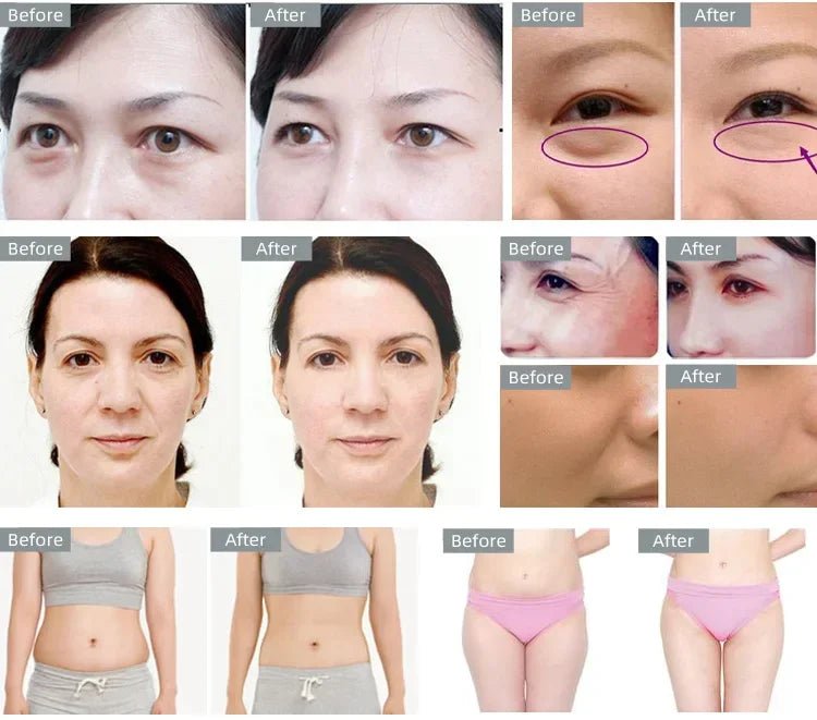 Body Slimming 40K Cavitation Ultrasonic Beauty Machine - Afrotix