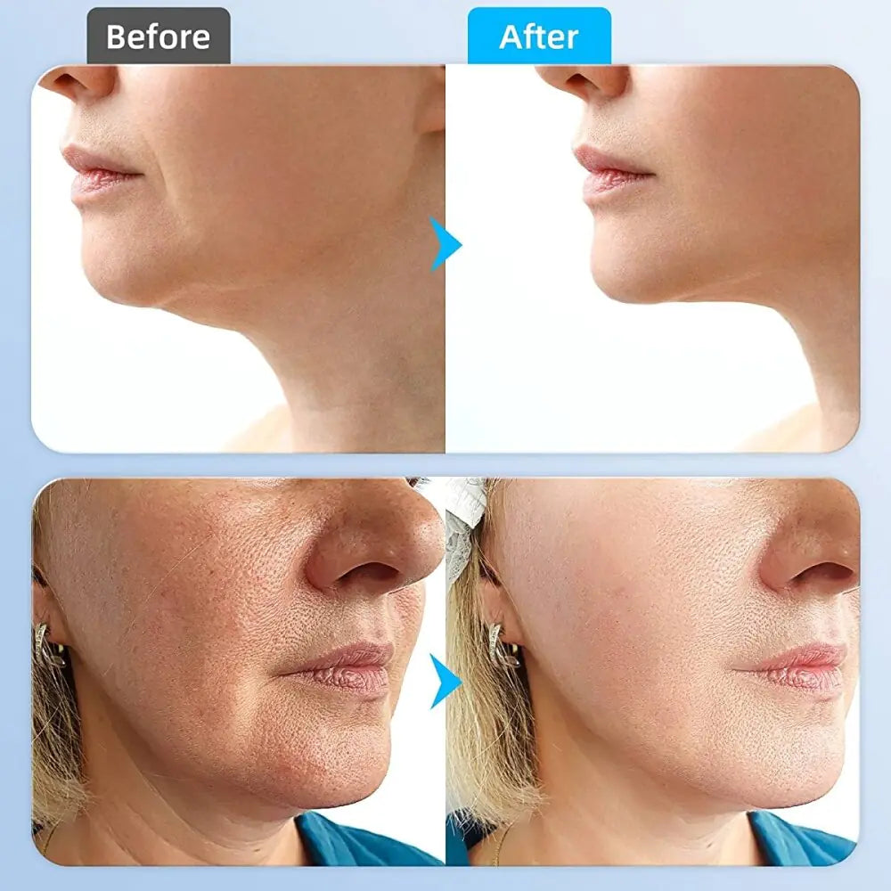Microcurrent Face Massager Anti Wrinkle Skin - Afrotix