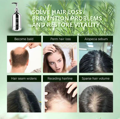 Sysni Organic Rosemary Shampoo And Tea Tree Special Shampoo, Keratin NourIshing Shampoo ,Promote Hair Growth, Strengthening Shampoo, Prevent Hair Loss Cleansing Shampoo,Deep Cleans, Refreshes Scalp, F eprolo