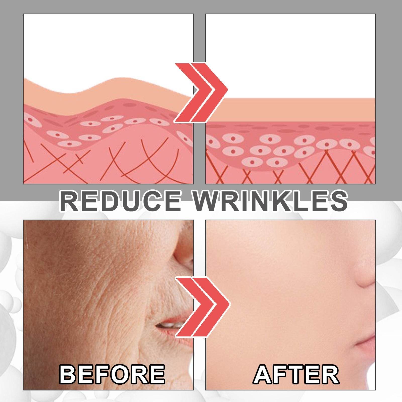 EELHOE Collagen Anti Wrinkle Cream Collagen Is Reconstituted Against Aging To Weaken Fine Lines Moisturize And Tighten Skin - Afrotix