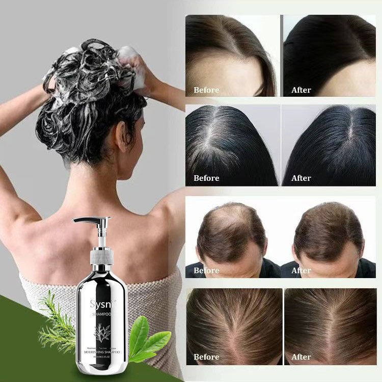 Sysni Organic Rosemary Shampoo And Tea Tree Special Shampoo, Keratin NourIshing Shampoo ,Promote Hair Growth, Strengthening Shampoo, Prevent Hair Loss Cleansing Shampoo,Deep Cleans, Refreshes Scalp, F eprolo