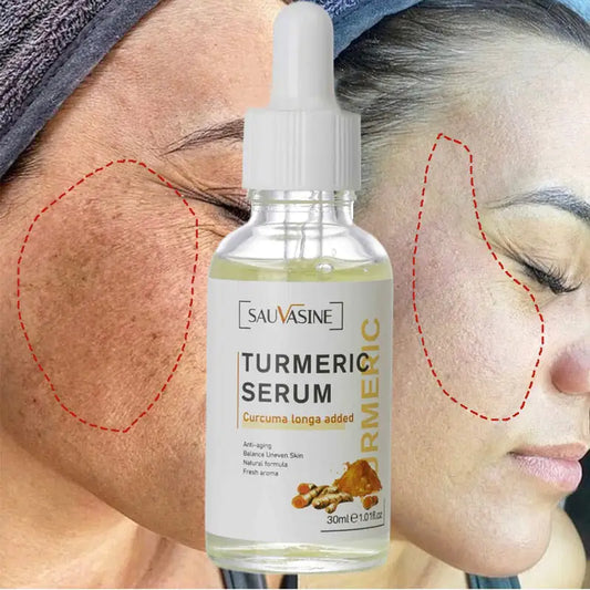 Turmeric Face Whitening Serum - Afrotix