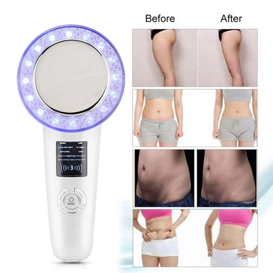 6 - in - 1 EMS Body Slimming Massager: RF Ultrasonic Cavitation & Anti - Cellulite Fat Burner - Afrotix