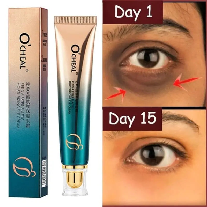 New Anti-Wrinkle Eye Cream - Afrotix