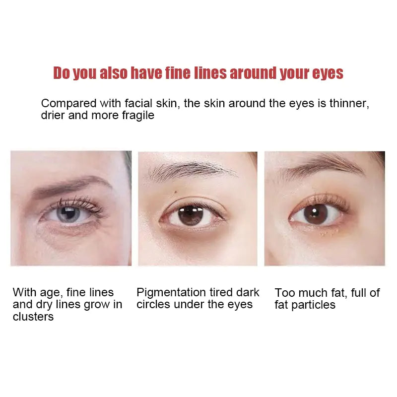 New Anti-Wrinkle Eye Cream - Afrotix