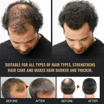 Hair Growth Shampoo - Afrotix