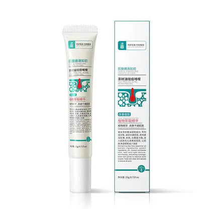 Herbal Acne Removal Face Cream - Afrotix