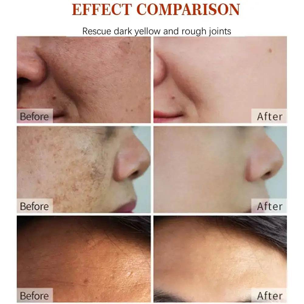 Korean Natural Vegan Neck Facial - Afrotix
