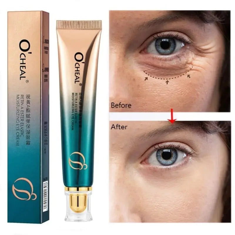 New Anti-Wrinkle Eye Cream - Afrotix
