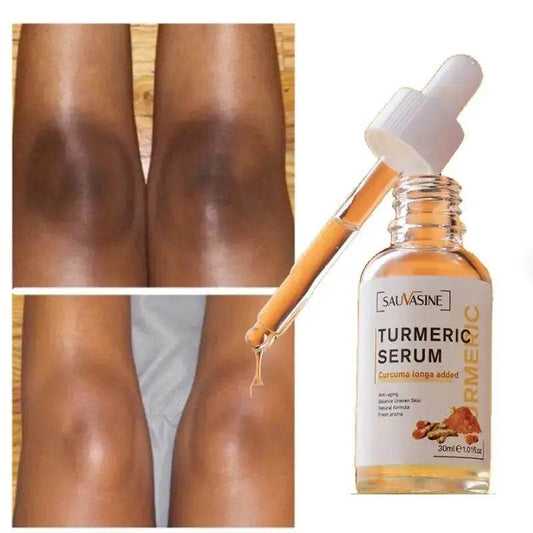 Natural Glow Serum: Turmeric Infused Skincare Solution - Afrotix