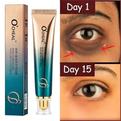 New Anti-Wrinkle Eye Cream - Afrotix