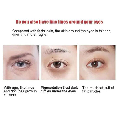 New Anti-Wrinkle Eye Cream - Afrotix