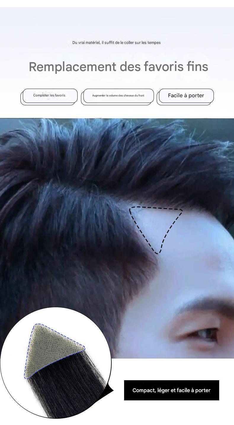 Hair Patch Small Area Hair Patch Spot Supply Afrotix