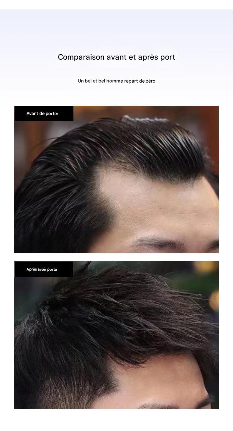 Hair Patch Small Area Hair Patch Spot Supply Afrotix
