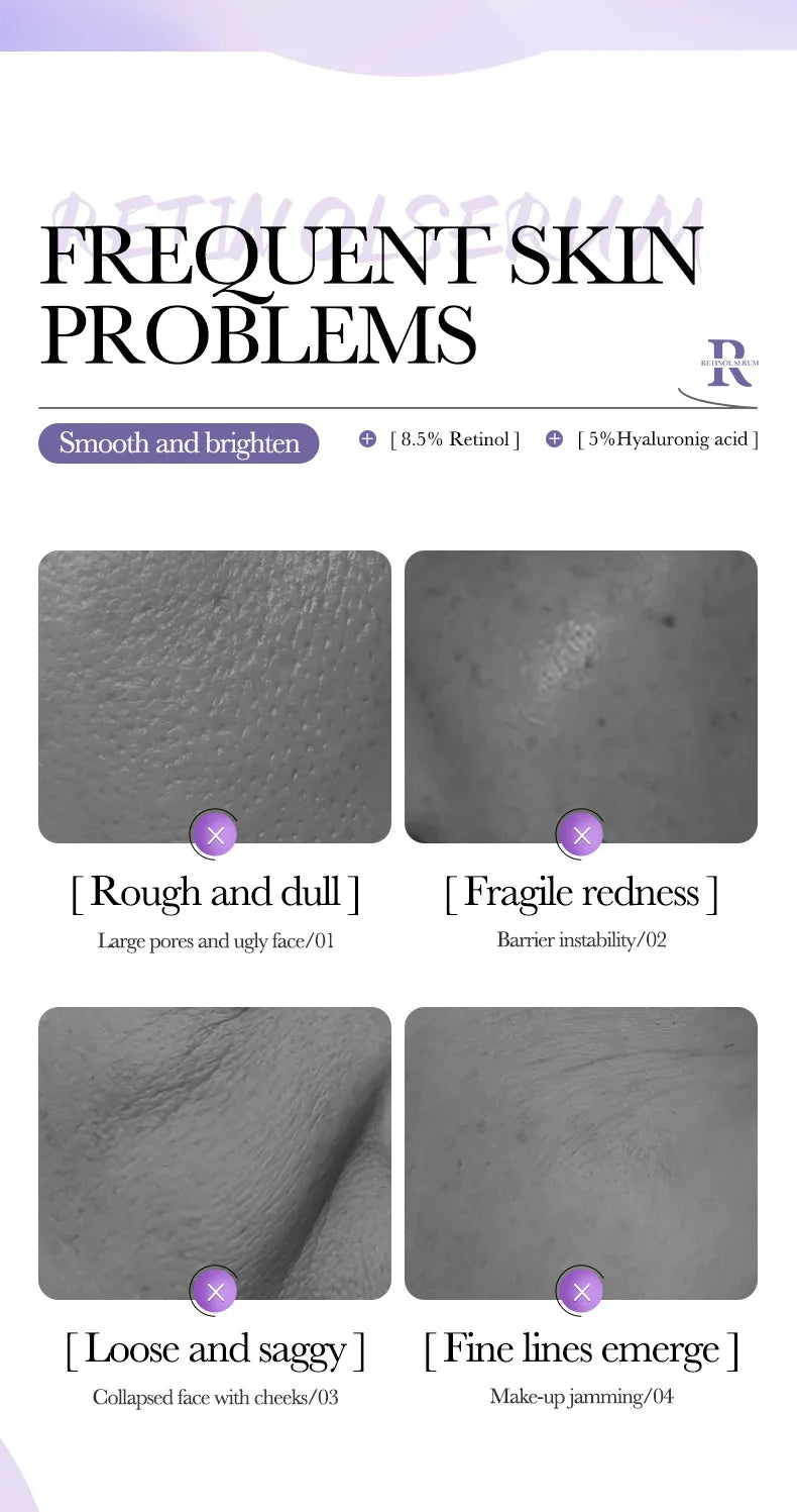 3 sérums faciales que combinan vitamina C, retinol y ácido hialurónico,