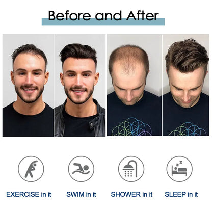 Prótesis capilares masculinas Microskin Peluquines de cabello humano Prótesis capilares para hombres