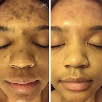 Turmeric Face Whitening Serum - Afrotix