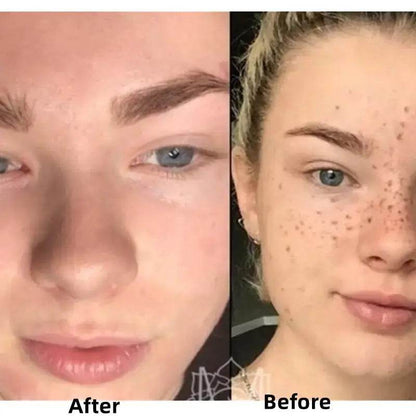 Turmeric Face Whitening Serum - Afrotix
