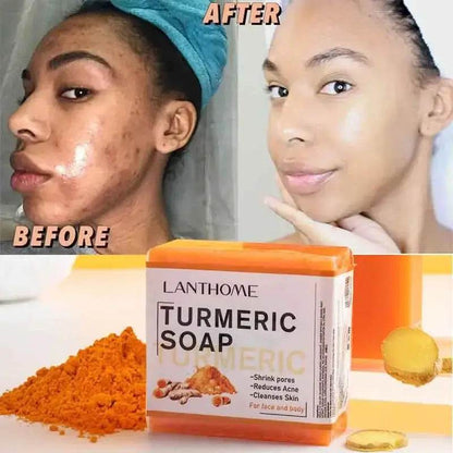 Turmeric Soap Face Cleansing Anti Acne - Afrotix