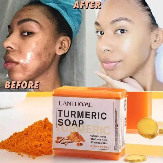 Turmeric Soap Face Cleansing Anti Acne - Afrotix