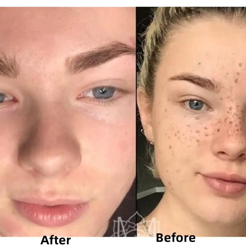 Turmeric Face Whitening Serum - Afrotix