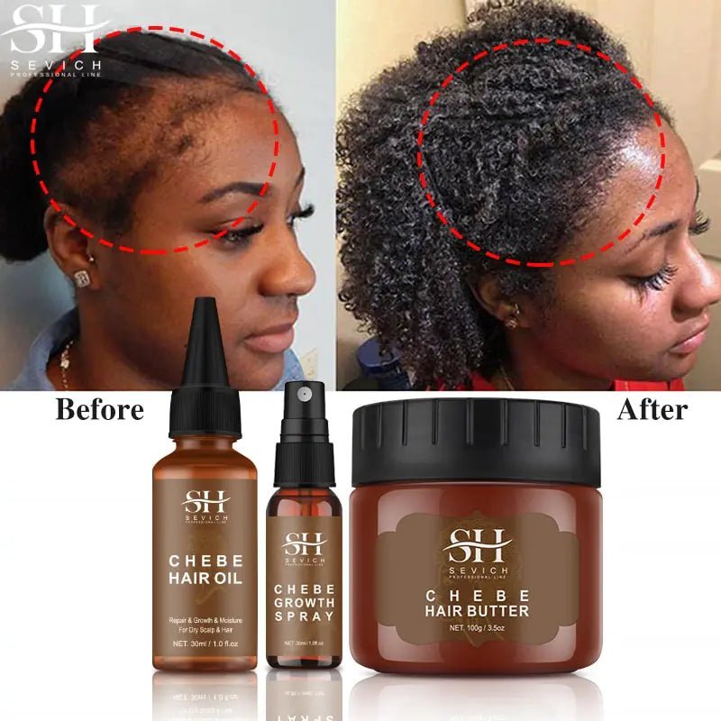 African Crazy Hair Growth Spray - Afrotix