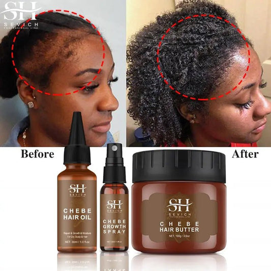 African Crazy Hair Growth Spray - Afrotix