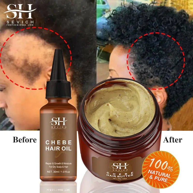 African Crazy Hair Growth Spray - Afrotix