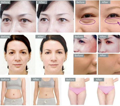 Body Slimming 40K Cavitation Ultrasonic Beauty Machine - Afrotix
