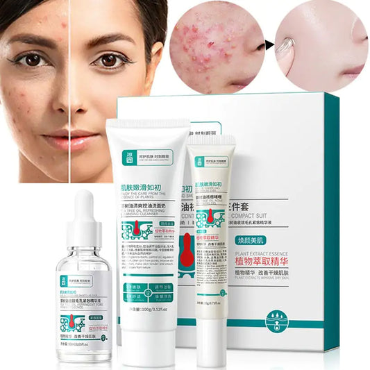 Herbal Acne Removal Face Cream - Afrotix