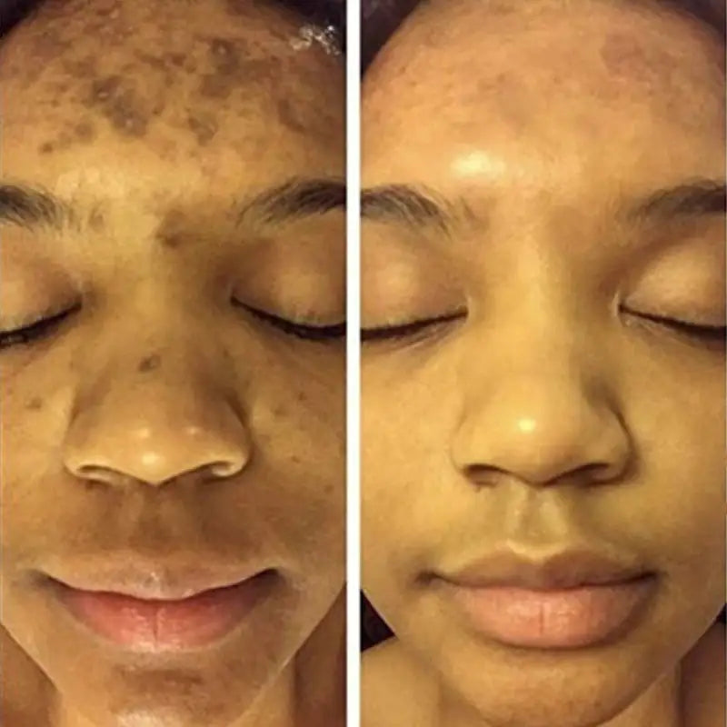 Turmeric Face Whitening Serum - Afrotix