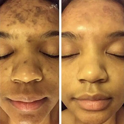 Turmeric Face Whitening Serum - Afrotix