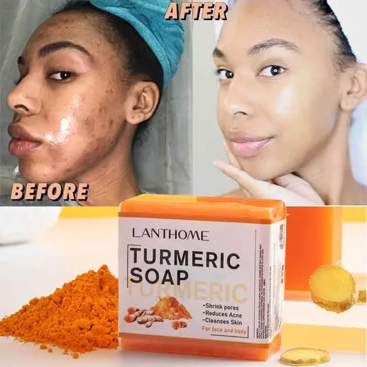 Turmeric Soap Face Cleansing Anti Acne - Afrotix