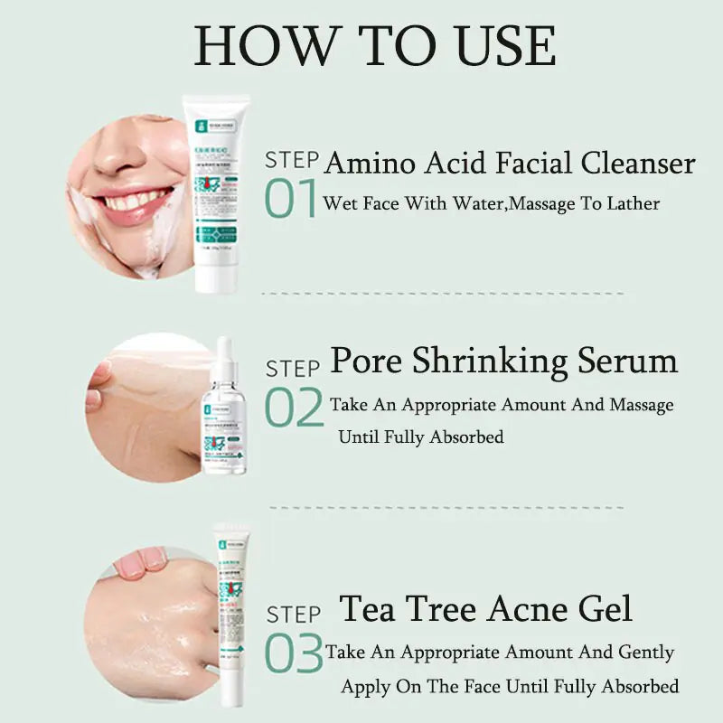 Herbal Acne Removal Face Cream - Afrotix